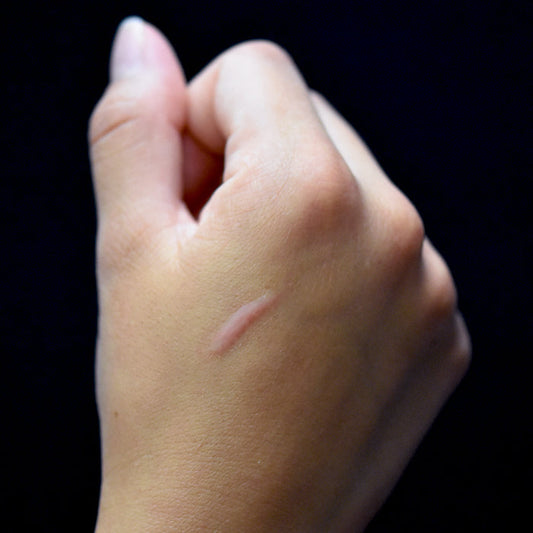 3/4 inch Scar