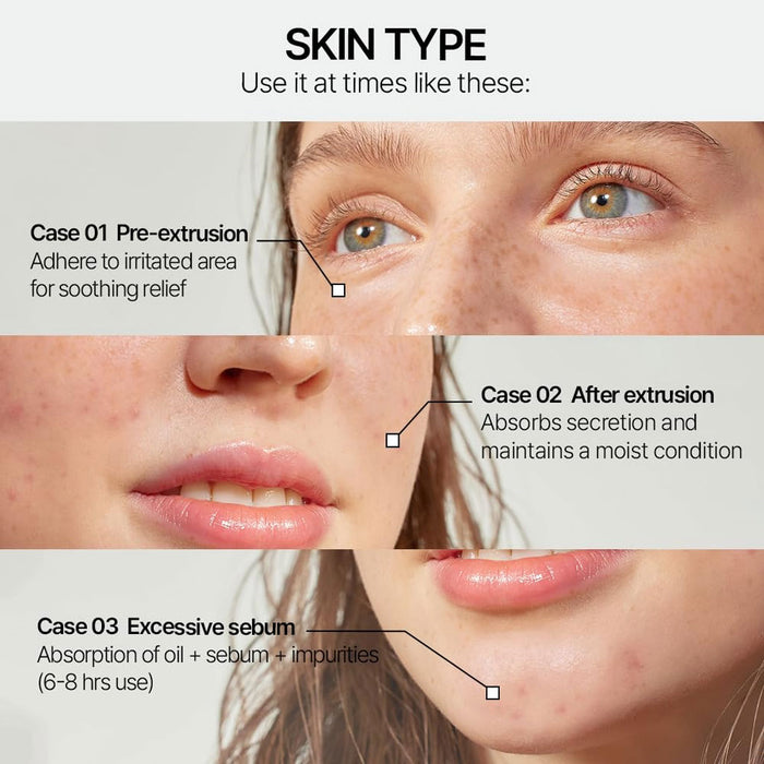 Parnell Cicamanu Clear Patch (48ea) Nudie Glow Australia
