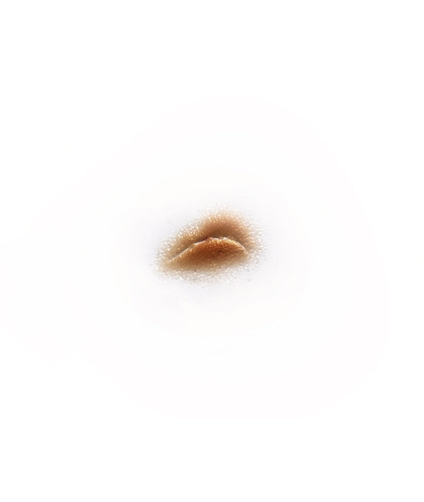 Curved Depressed Scar