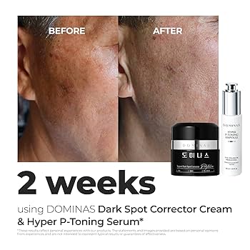 Dominas Targeted Dark Spot Corrector Cream