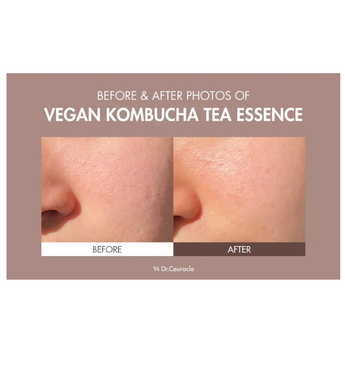 Dr.Ceuracle Vegan Kombucha Tea Essence 5.07 fl.oz. / 150ml