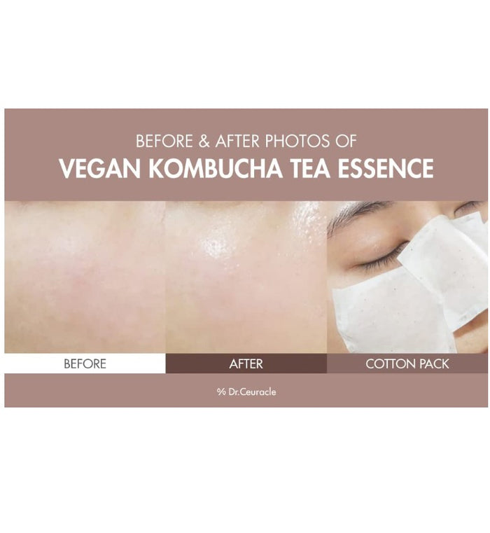 Dr.Ceuracle Vegan Kombucha Tea Essence 5.07 fl.oz. / 150ml