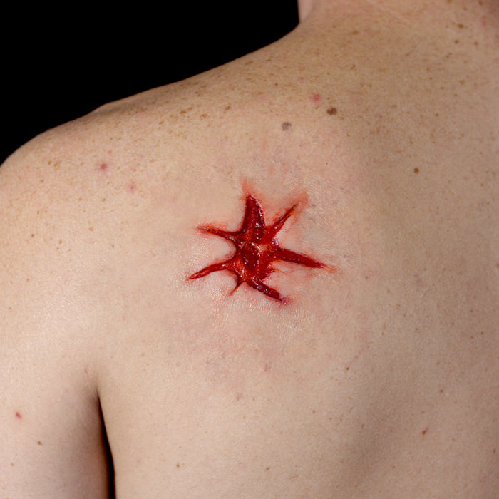 Firearm Injury