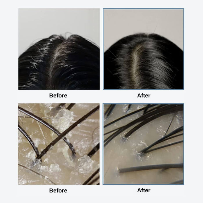 GROWUS Sea Salt Therapy Scalp Scaler 250g