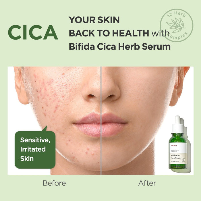 ma:nyo Bifida Cica Herb Serum 1.69 fl. oz. / 50ml