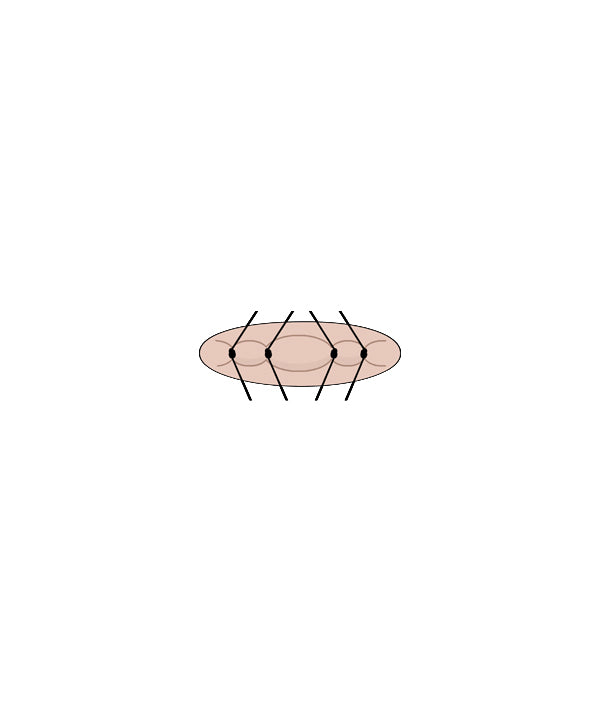 Micro Suture 4 Stitch