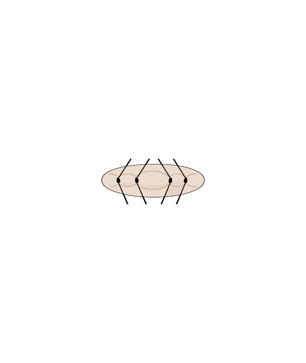 Micro Suture 4 Stitch