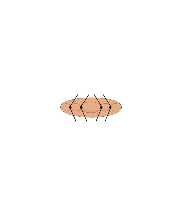 Micro Suture 4 Stitch