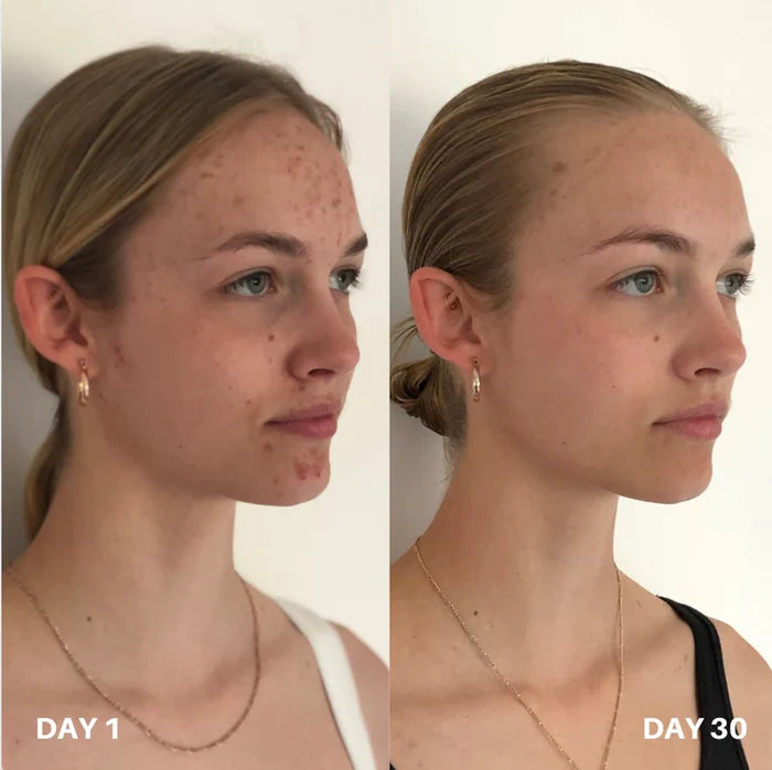Skin Purifier Pour