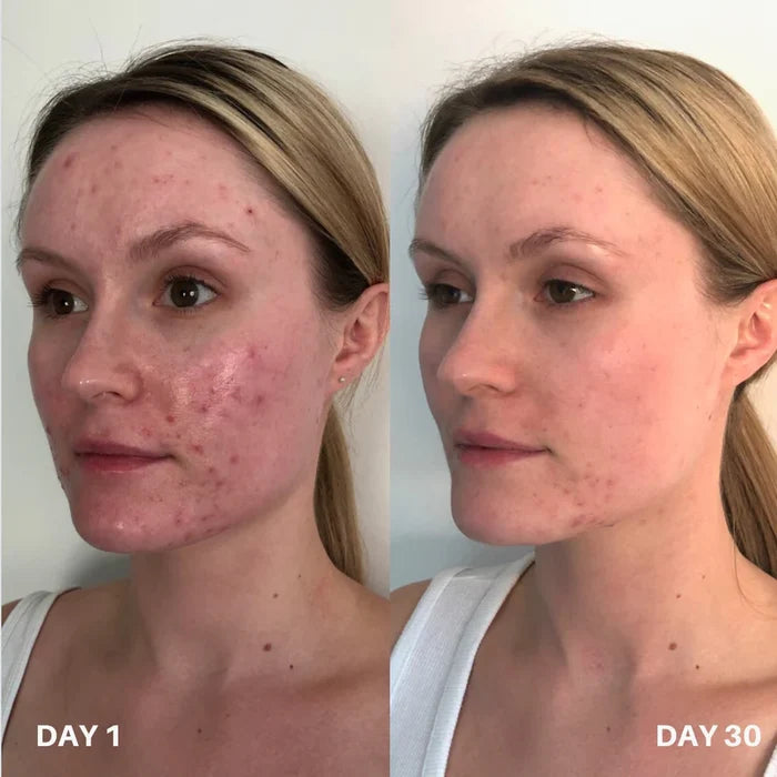 Skin Purifier Pour