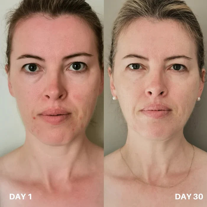 Skin Purifier Pour