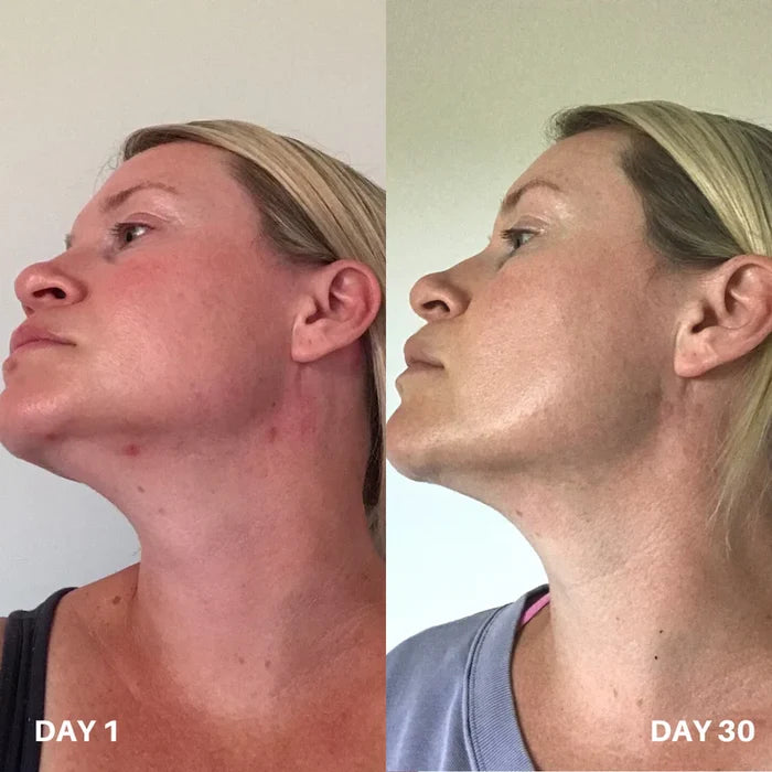 Skin Purifier Pour