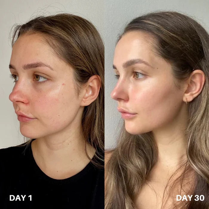 Skin Purifier Pour