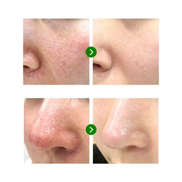SOME BY MI Super Matcha Pore Tightening Serum Nudie Glow Australia